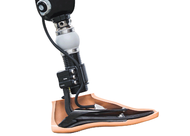 ossur-prosthetic