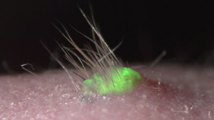 Lab Proves Transplanted Skin Can Grow Hair