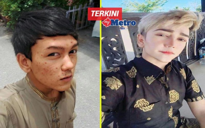 Malaysian Man Spent $41K on Cosmetic Surgery to Look Final Fantasy Character